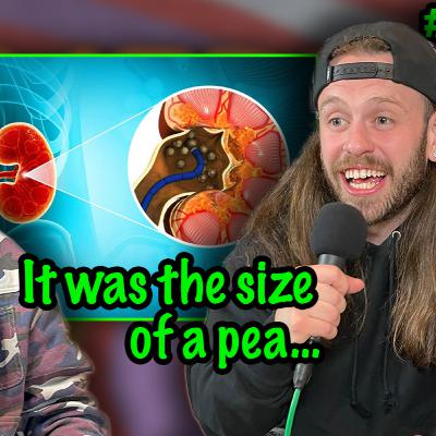 He Passed a Kidney Stone by Jerking Off?! (Ep43)