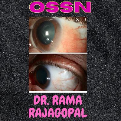OSSN by DR RAMA RAJAGOPAL