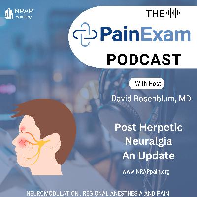 Post Herpetic Neuralgia- An Update