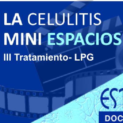 MINI ESPACIO "LA CELULITIS". Tratamiento LPG. MINI ESPACIO "LA CELULITIS". Tratamiento LPG.
