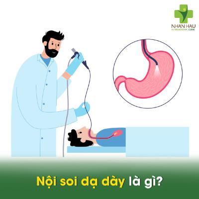 Nội soi dạ dày là gì: Ưu điểm và nhược điểm của nội soi dạ dày Nội soi dạ dày là gì: Ưu điểm và nhược điểm của nội soi dạ dày