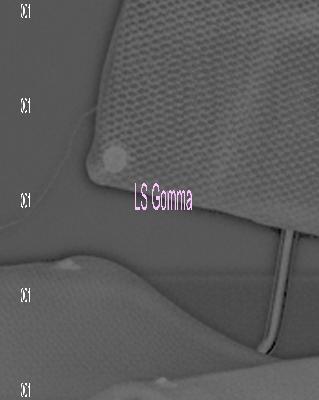 Process & New Materiality: LS Gomma Process & New Materiality: LS Gomma