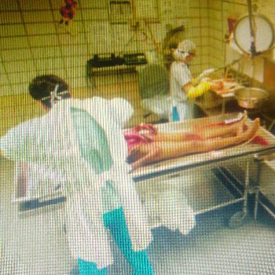 En este podcast hablaremos sobre la medicina legal o medicina forense