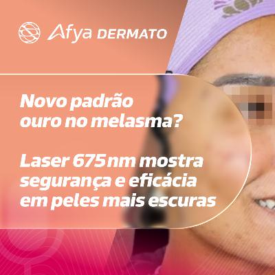 Novo padrão ouro no melasma? Laser 675 nm mostra segurança e eficácia em peles mais escuras