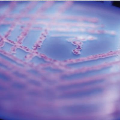 Molecular Cloning Methods (CMB part 2) Molecular Cloning Methods (CMB part 2)