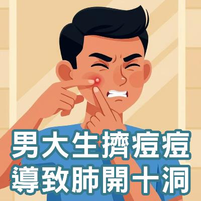 【S2 EP.115】男大生擠痘痘導致肺開十洞! P電漿可以改善痘痘嗎？