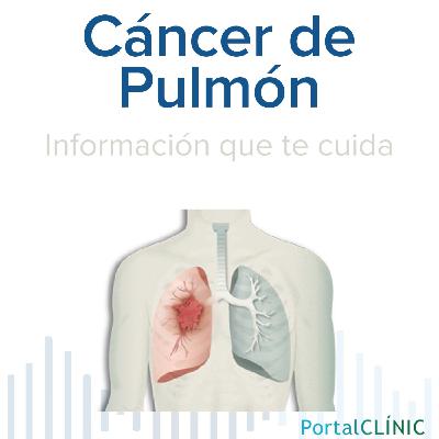 'El tabaco es la principal causa del cáncer de pulmón' | Cáncer de pulmón | Podcast 'El tabaco es la principal causa del cáncer de pulmón' | Cáncer de pulmón | Podcast