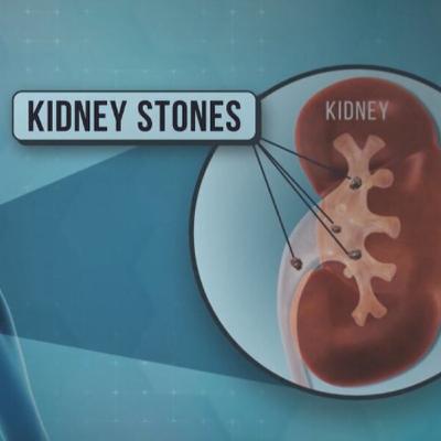 Mike's Painful Weekend Mike's Painful Weekend