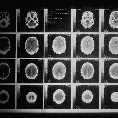 Firefighter Cancer Fact Check