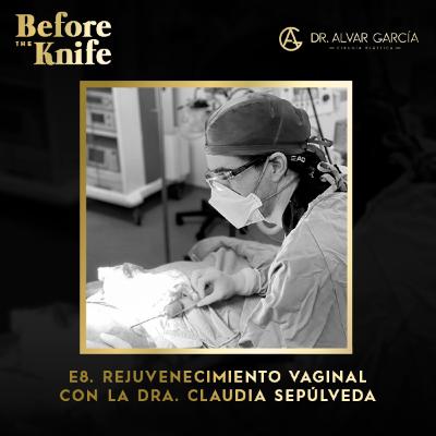 008 - Rejuvenecimiento Vaginal con la Dra. Claudia Sepulveda