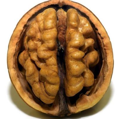 Neuropsykologi