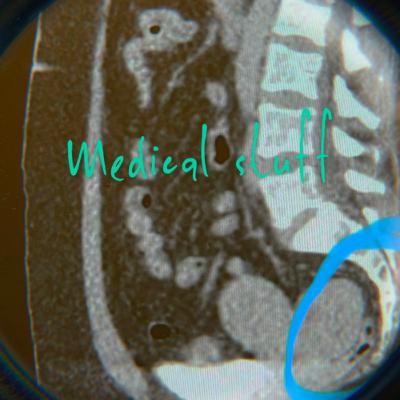 #8 Spilling my frijoles and guts