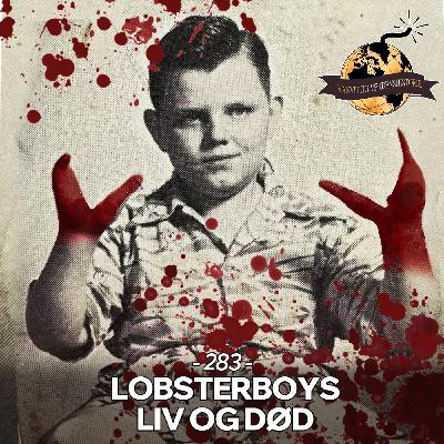 #283: Lobsterboys Liv og Død