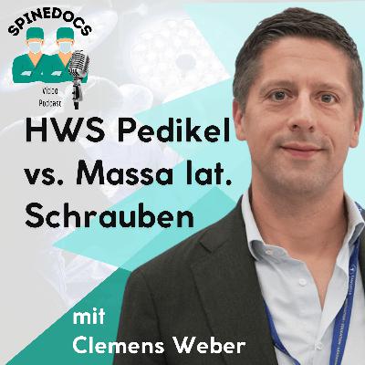 HWS Pedikel vs. Massa lateralis Schrauben