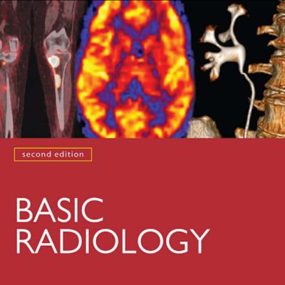 kami dan radio mirasantika fm kami dan radio mirasantika fm