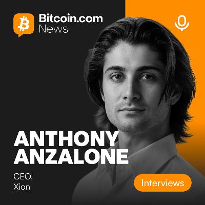 He burned a real Banksy to prove a point and sold it for $400K - Anthony Anzalone