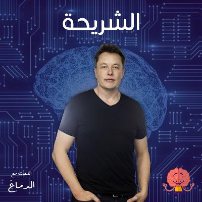 شريحة إيلون ماسك