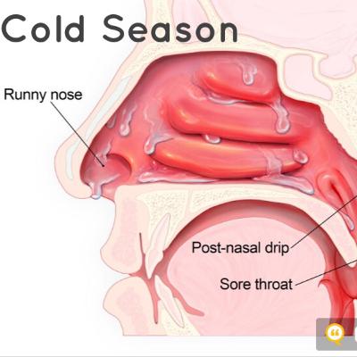 It’s that time of the year.......COLDS!