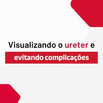 Visualizando o ureter e evitando complicações Visualizando o ureter e evitando complicações