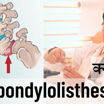 Spondylolisthesis क्या होता है ? What is Spondylolisthesis? Complete Info in Hindi - By Dr Hitesh Garg Spondylolisthesis क्या होता है ? What is Spondylolisthesis? Complete Info in Hindi - By Dr Hitesh Garg