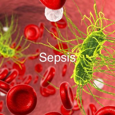 Sepsis