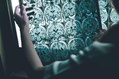 How good is your memory?