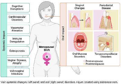 My Gum Graft, My Third Child: What Perimenopause Did to My Mouth