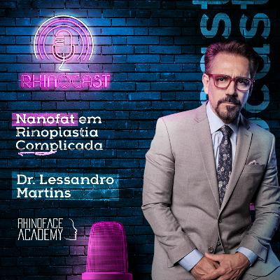 Nanofat em Rinoplastias Complicadas | Dr. Lessandro Martins Nanofat em Rinoplastias Complicadas | Dr. Lessandro Martins