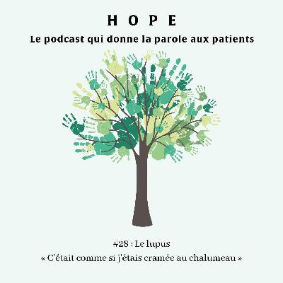 Le lupus : « C'était comme si j'étais cramée au chalumeau » Le lupus : « C'était comme si j'étais cramée au chalumeau »