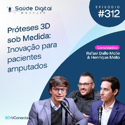 SD312 - Próteses 3D sob Medida: Inovação para pacientes amputados