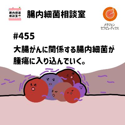#455 大腸がんに関係する腸内細菌が腫瘍に入り込んでいく。 #455 大腸がんに関係する腸内細菌が腫瘍に入り込んでいく。
