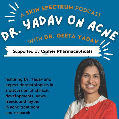 Yadav on Acne S02E01 - Managing Moderate-to-Severe Acne with Isotretinoin Yadav on Acne S02E01 - Managing Moderate-to-Severe Acne with Isotretinoin