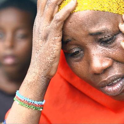 Somalia faces worsening drought emergency amid critical aid shortages