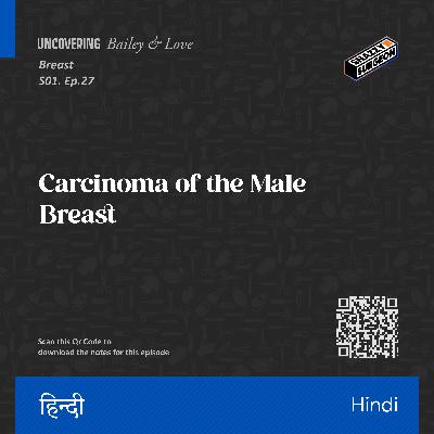 S.01 Ep.27 Carcinoma of the Male Breast_Hindi