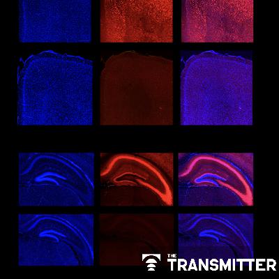 Ramping up cortical activity in early life sparks autism-like behaviors in mice Ramping up cortical activity in early life sparks autism-like behaviors in mice