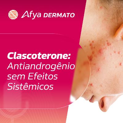 Clascoterone 1%: o antiandrogênio tópico que mudou o jogo