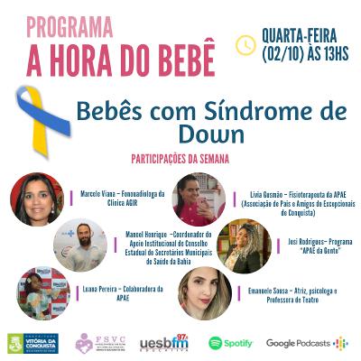 033 - Bebês com Síndrome de Down