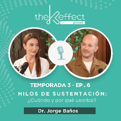 ✨Hilos de Sustentación – ¿Cuándo y por qué usarlos?