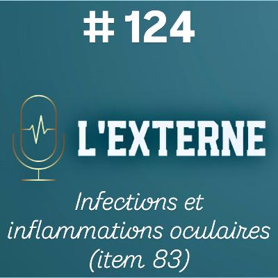 Episode 124 - Infections et inflammations oculaires (item 83) Episode 124 - Infections et inflammations oculaires (item 83)