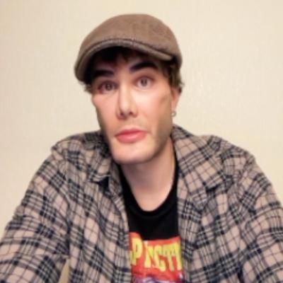 HY USMLE Q #1495 – Endocrine HY USMLE Q #1495 – Endocrine