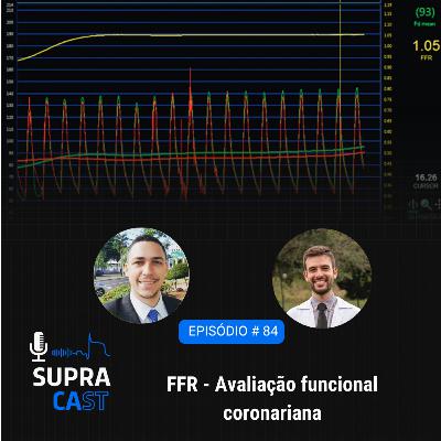 84. FFR Avaliação Funcional Coronariana