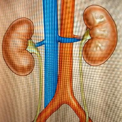 85 millions of world population are Kidney patients.The talk is in "Tamil."