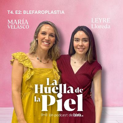 T4. E2. Leyre Lloreda: Blefaroplastias