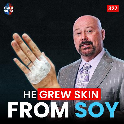 327. Derm: Why Every Soldier's Backpack Needs Omega Sheets with Joseph Connell CEO of NeuEsse Inc. 327. Derm: Why Every Soldier's Backpack Needs Omega Sheets with Joseph Connell CEO of NeuEsse Inc.