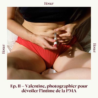 Ep.11 - Valentine, photographier pour dévoiler l'intime de la PMA Ep.11 - Valentine, photographier pour dévoiler l'intime de la PMA