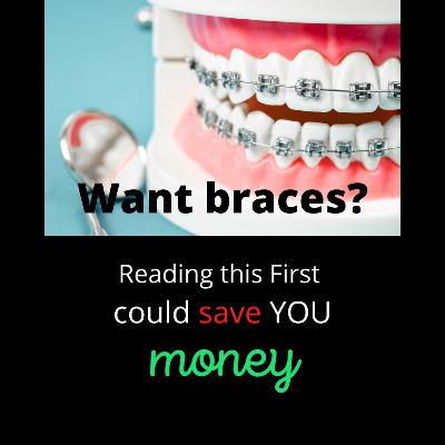 Braces: Pricing and How YOU Can Save BIG
