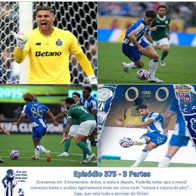 Episódio 374 - 3 Partes