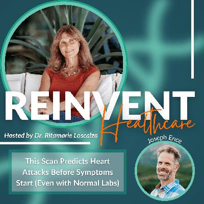 This Scan Predicts Heart Attacks Before Symptoms Start (Even with Normal Labs) This Scan Predicts Heart Attacks Before Symptoms Start (Even with Normal Labs)