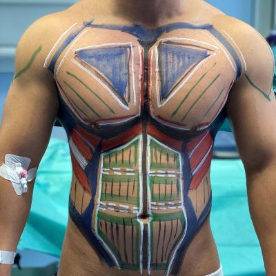 Sixpack OP - Schönheitschirurgie Mc Aesthetics Sixpack OP - Schönheitschirurgie Mc Aesthetics