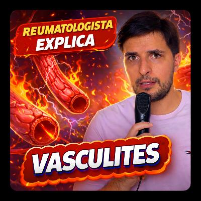 JUNTA #19 Vasculites: o que são, como diagnosticar e por que são tão complexas? JUNTA #19 Vasculites: o que são, como diagnosticar e por que são tão complexas?